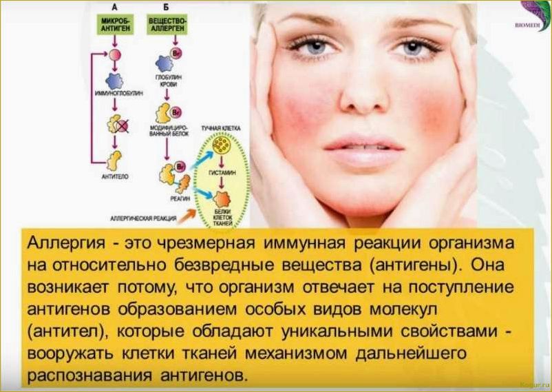 Аллергия на арбуз: симптомы, причины и способы лечения