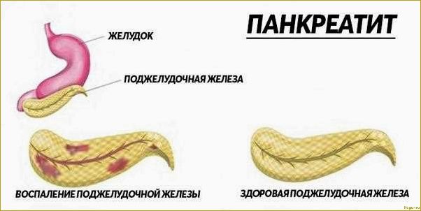 Влияние употребления дыни при панкреатите: польза или вред?